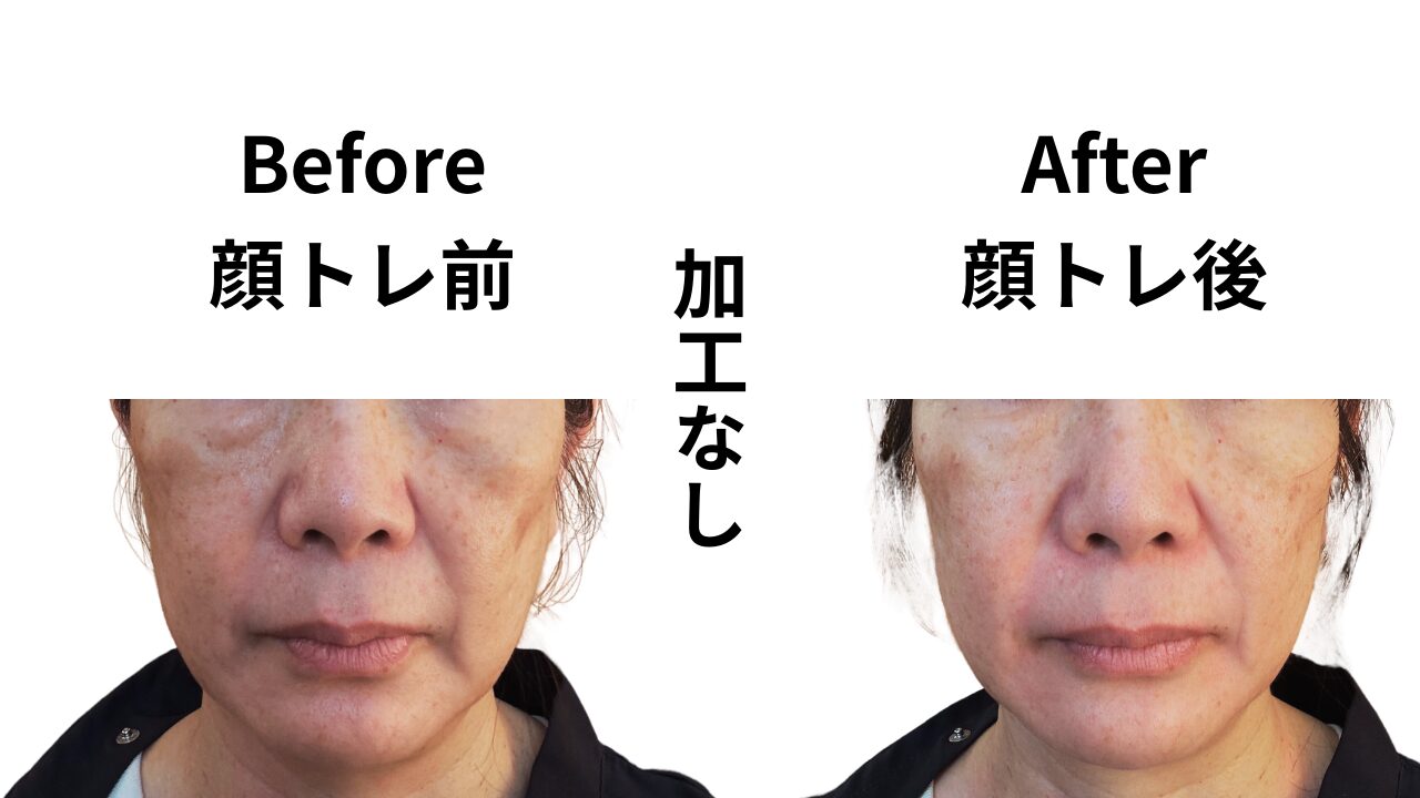顔トレ前後のビフォーアフター